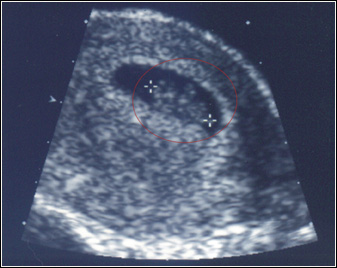 baby_1.jpg